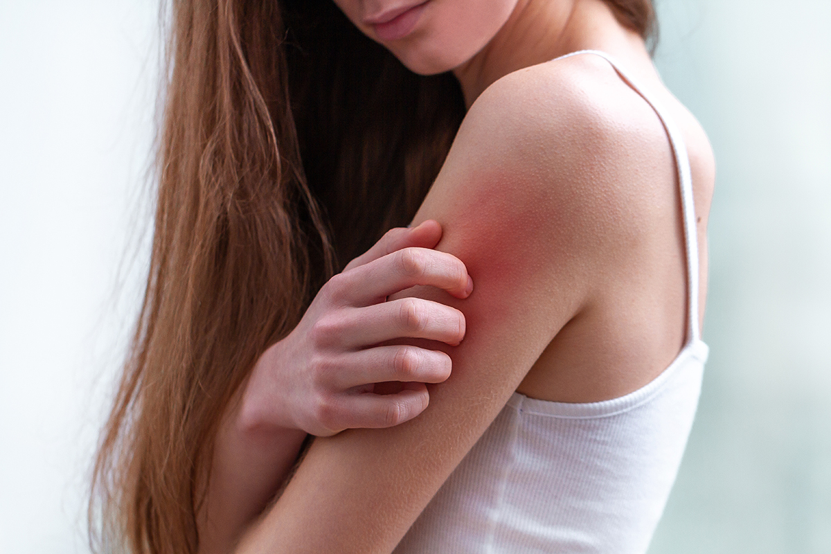 10 afecțiuni comune ale pielii