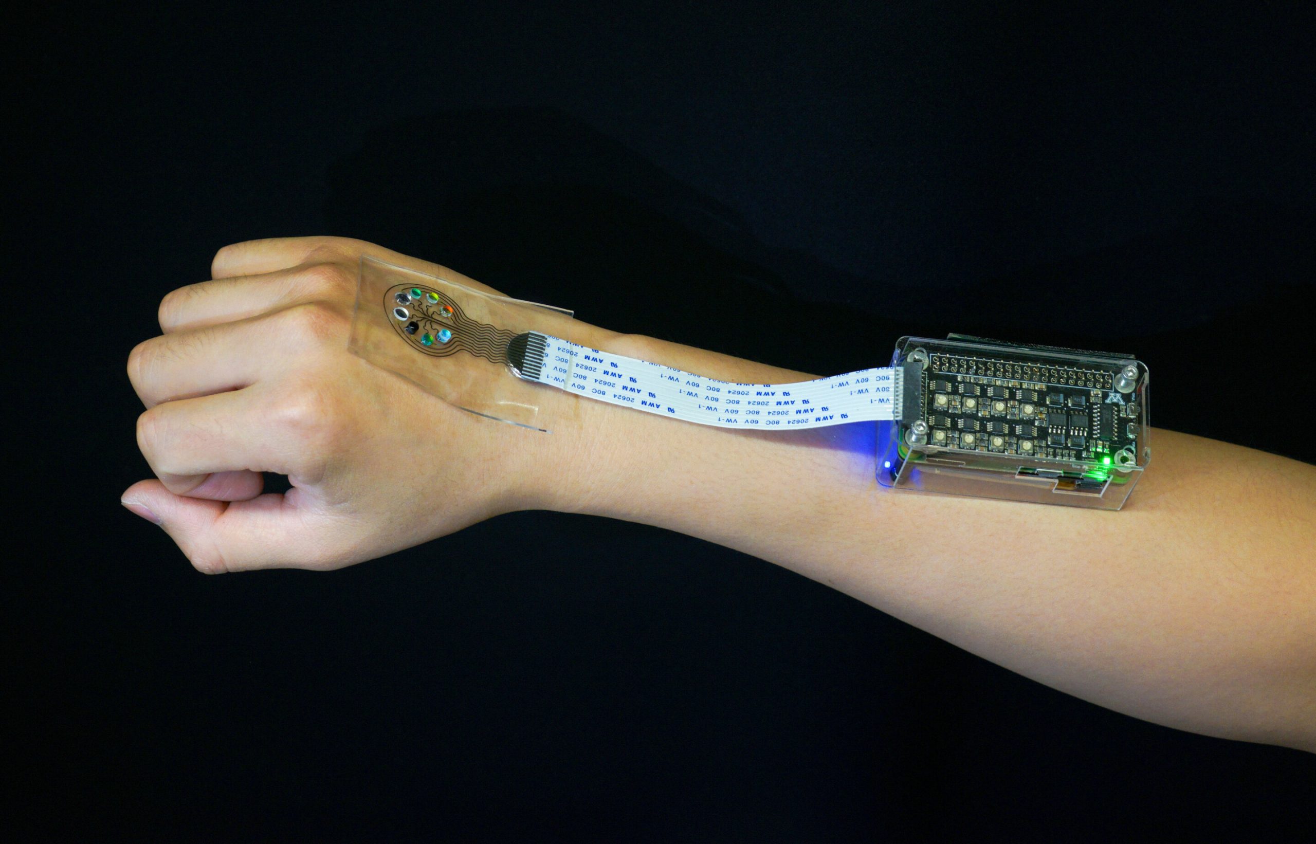 Dispozitivul unic cu senzor de lumină imprimat 3D ar putea ajuta persoanele cu lupus